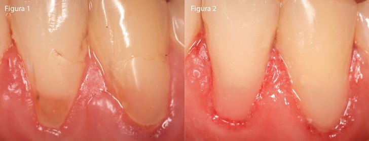 Clinical_PermaFlo_Dr.Krylova_1108