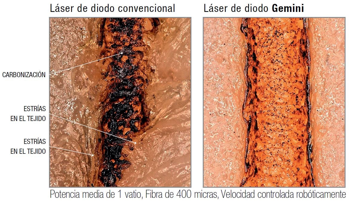 laser diodo para que sirve