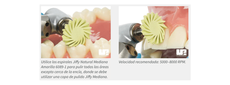 Jiffy Natural Yellow