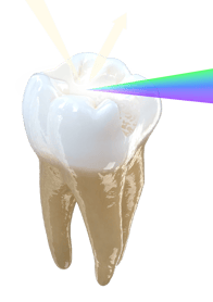 MOD_Molar_Partial_View_3D