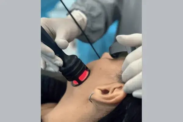 Parestesia (hormigueo o adormecimiento)