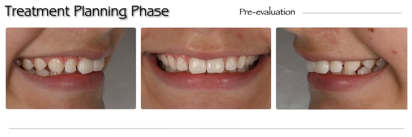 Artigo CHAIRSIDE Ultradent 2024.002
