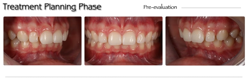 Artigo CHAIRSIDE Ultradent 2024.003