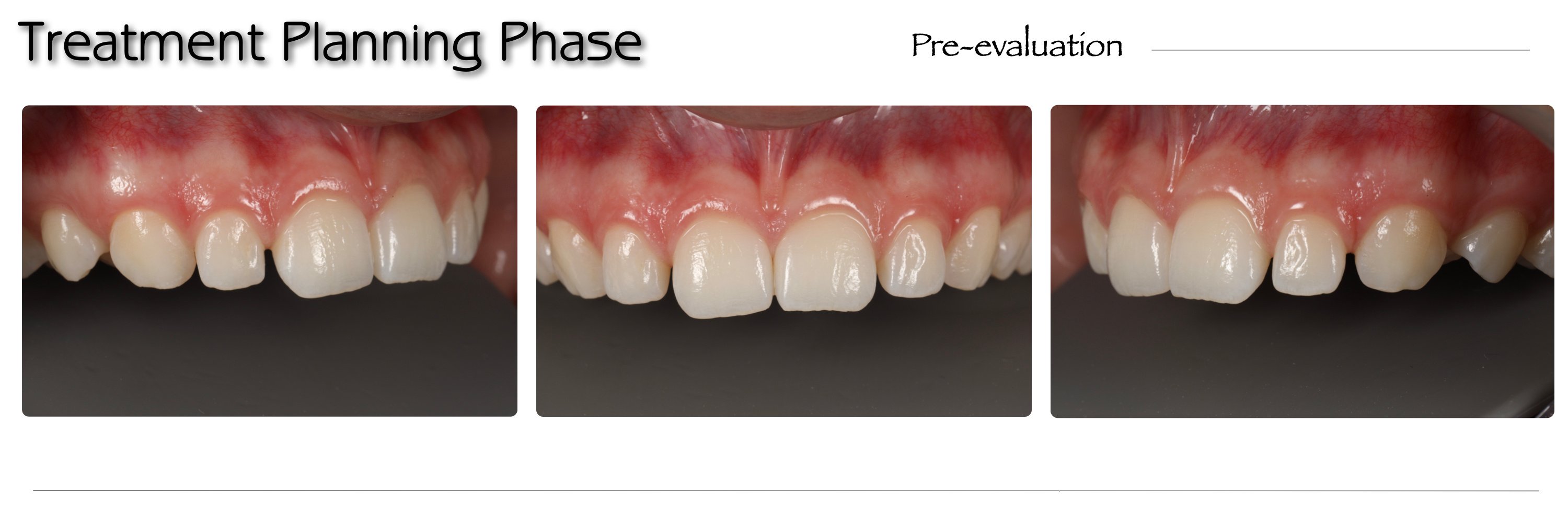 Artigo CHAIRSIDE Ultradent 2024.004