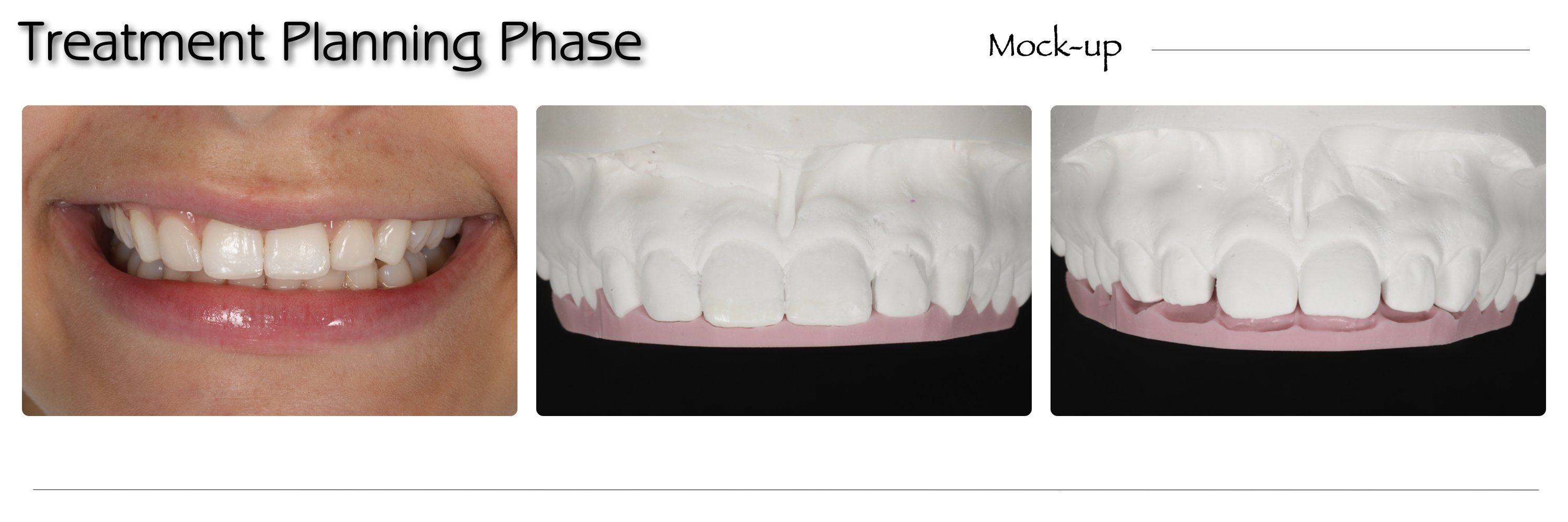 Artigo CHAIRSIDE Ultradent 2024.009