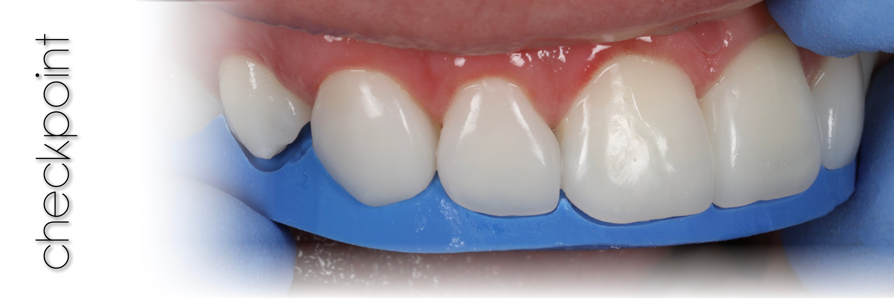 Artigo CHAIRSIDE Ultradent 2024.021