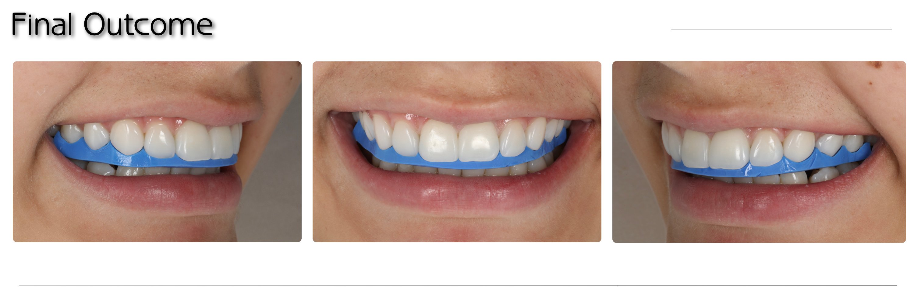 Artigo CHAIRSIDE Ultradent 2024.023
