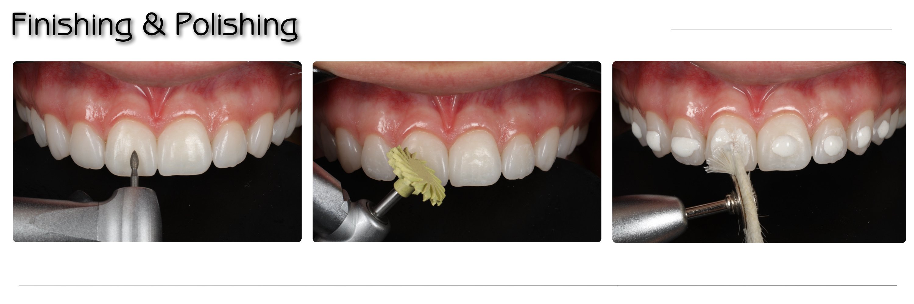 Artigo CHAIRSIDE Ultradent 2024.024