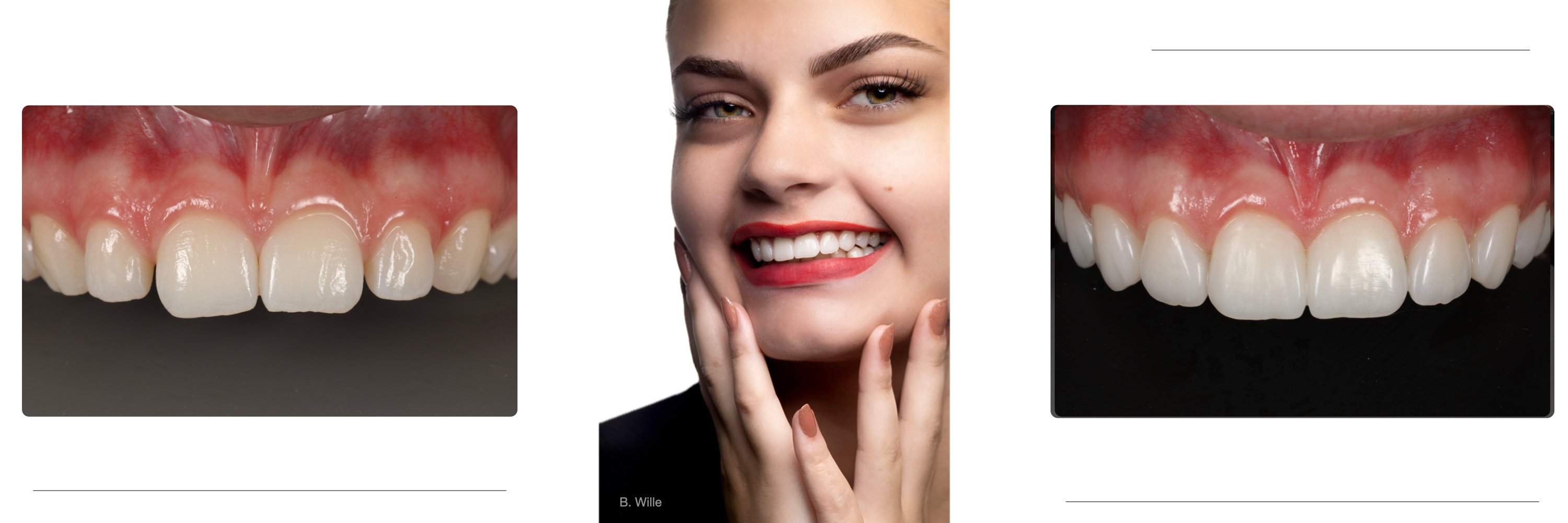Artigo CHAIRSIDE Ultradent 2024.025