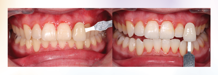 dra.jaleena-boost-and-go