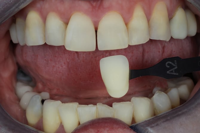 image-png-Mar-20-2026-11-43-05-0184-AM